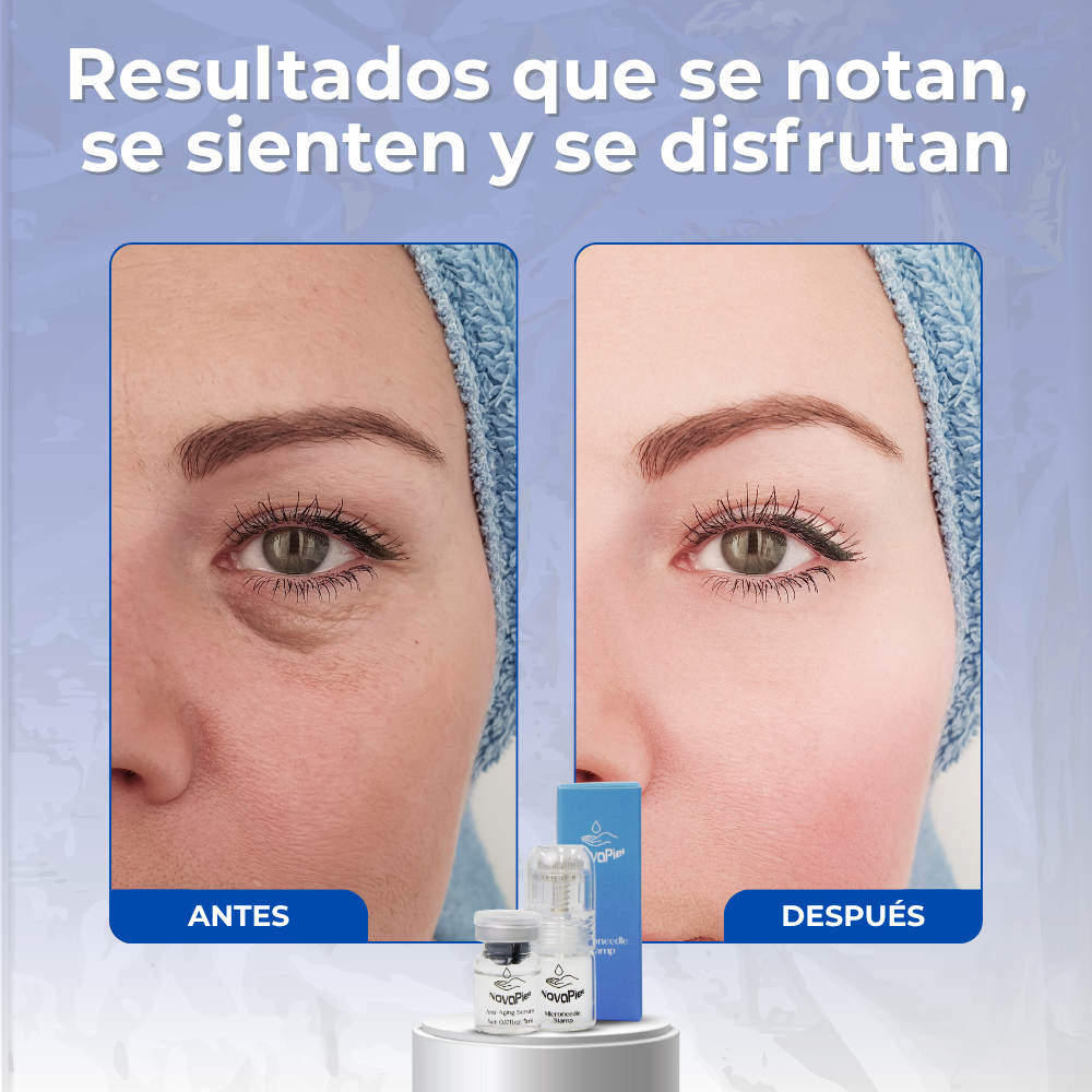 NovaPiel ReVive – Sistema de Microinfusión Facial Avanzada