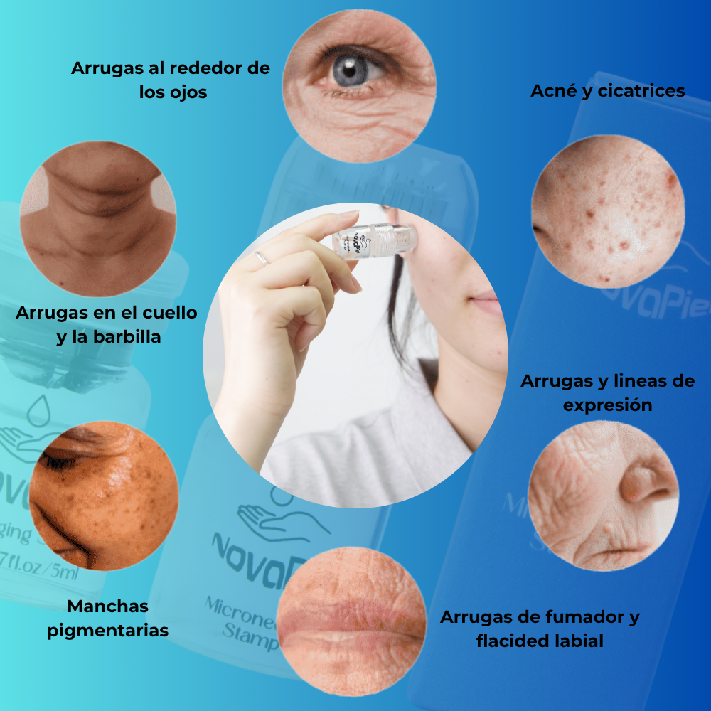 Tratamiento de Microinfusión NovaPiel